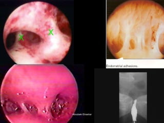 Aboubakr ElnasharAboubakr Elnashar  