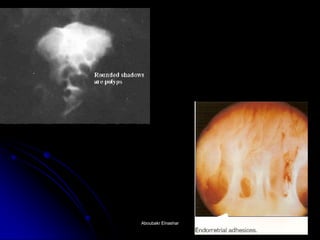 Aboubakr ElnasharAboubakr Elnashar  