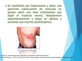 Romero-Pareyón, L. (2011). Artículo de revisión “Herpes Zóster”. Revista mexicana de dermatología. Volumen 55, Núm. 1.
Arenas, R. Dermatología: atlas, diagnóstico y tratamiento. McGraw-hill. México.
 