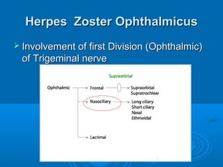 Herpes Zoster Ophthalmicus
 Involvement of first Division (Ophthalmic)
 of Trigeminal nerve
 