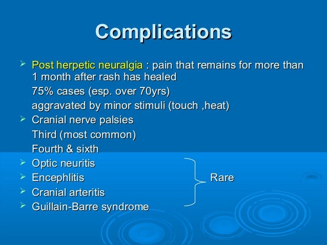 Herpes Zoster Ophthalmicus