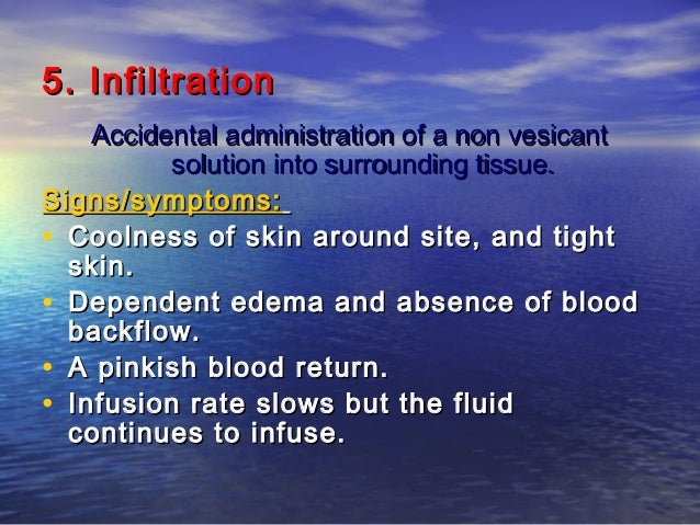 What Is An Example Of A Non Vesicant Solution? – KUTN