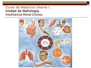Curso de Medicina Interna I.
Unidad de Nefrologia.
Insuficiencia Renal Crónica.

 