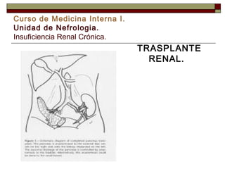 Curso de Medicina Interna I.
Unidad de Nefrologia.
Insuficiencia Renal Crónica.

TRASPLANTE
RENAL.

 