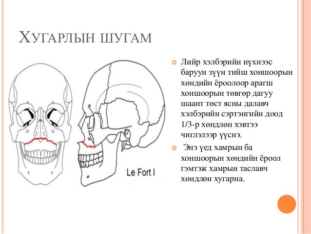 лефорд I