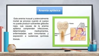 Esta anemia inusual y potencialmente
mortal se provoca cuando el cuerpo
no puede producir suficientes glóbulos
rojos. Las causas de la anemia
aplásica comprenden infecciones,
determinados medicamentos,
enfermedades auto inmunitarias y
exposición a sustancias químicas
tóxicas.
16
Anemia aplásica
 