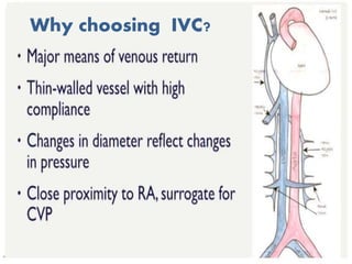 Why choosing IVC?
 