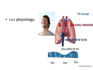 • i.v.c physiology:
 