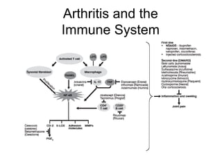 Arthritis and the
Immune System
 