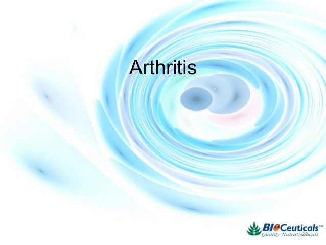 Natural Products As A Gold Mine For Arthritis Treatment Natural Products As A Gold Mine For Arthritis Treatment
