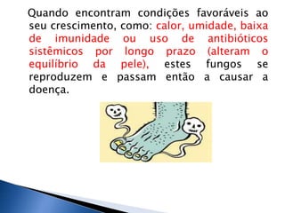 Quando encontram condições favoráveis ao
seu crescimento, como: calor, umidade, baixa
de imunidade ou uso de antibióticos
sistêmicos por longo prazo (alteram o
equilíbrio da pele), estes fungos se
reproduzem e passam então a causar a
doença.
 