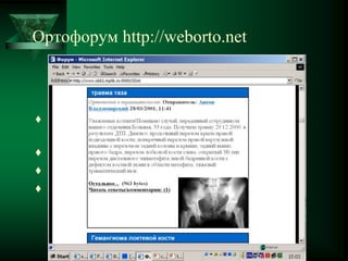 Ортофорум http://weborto.net
 Представление информации о пациенте с
передачей изображений (JPEG, GIF)
 Получение ответов консультантов
 Обсуждение
 Принятие решения
 