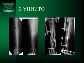 В УНИИТО
 