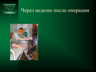 Через неделю после операции
 