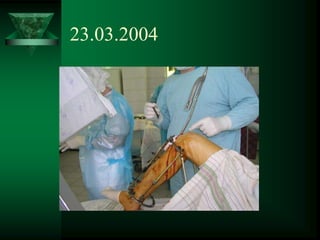 23.03.2004
 