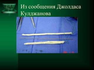 Из сообщения Джолдаса
Кулджанова
 