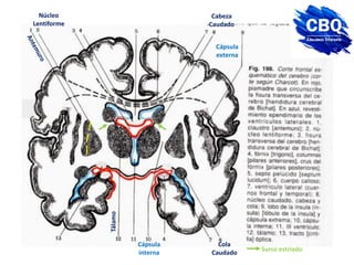 Núcleo
Lentiforme
Cabeza
Caudado
Cola
Caudado
Cápsula
interna
Cápsula
externa
Tálamo
Surco estriado
 