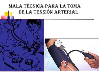 MALA TÉCNICA PARA LA TOMA  DE LA TENSIÓN ARTERIAL 