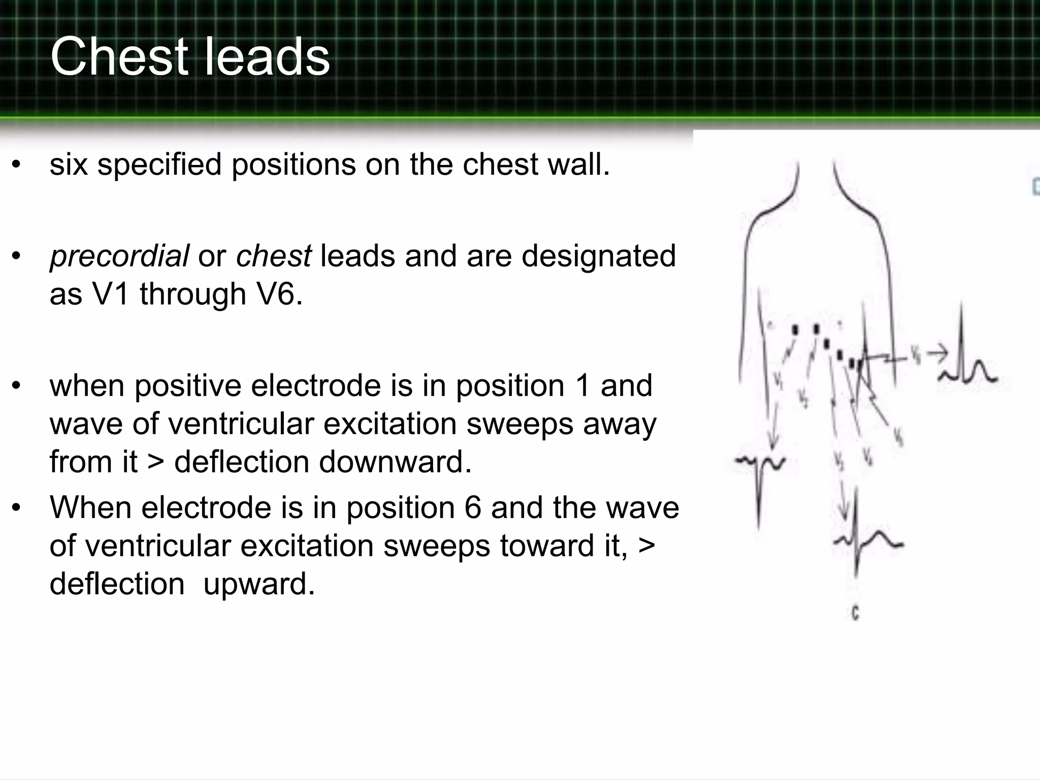 Chest leads 
• six specified positions on the chest wall. 
• precordial or chest leads and are designated 
as V1 through V6. 
• when positive electrode is in position 1 and 
wave of ventricular excitation sweeps away 
from it > deflection downward. 
• When electrode is in position 6 and the wave 
of ventricular excitation sweeps toward it, > 
deflection upward. 
 