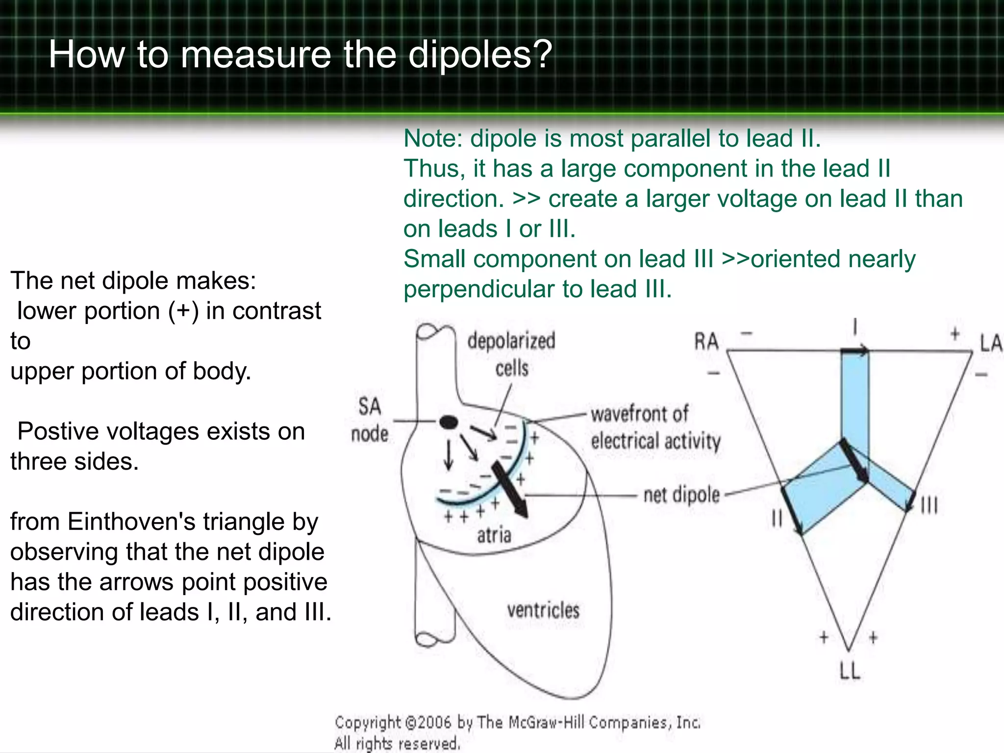 How to measure the dipoles? 
The net dipole makes: 
lower portion (+) in contrast 
to 
upper portion of body. 
Postive voltages exists on 
three sides. 
from Einthoven's triangle by 
observing that the net dipole 
has the arrows point positive 
direction of leads I, II, and III. 
Note: dipole is most parallel to lead II. 
Thus, it has a large component in the lead II 
direction. >> create a larger voltage on lead II than 
on leads I or III. 
Small component on lead III >>oriented nearly 
perpendicular to lead III. 
 