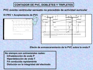 Holter de presión arterial: ¿Qué es y cuándo se indica?