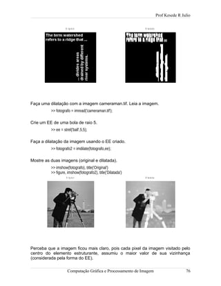 Prof Kesede R Julio
Faça uma dilatação com a imagem cameraman.tif. Leia a imagem.
>> fotografo = imread('cameraman.tif');
Crie um EE de uma bola de raio 5.
>> ee = strel('ball',5,5);
Faça a dilatação da imagem usando o EE criado.
>> fotografo2 = imdilate(fotografo,ee);
Mostre as duas imagens (original e dilatada).
>> imshow(fotografo), title('Original')
>> figure, imshow(fotografo2), title('Dilatada')
Perceba que a imagem ficou mais claro, pois cada pixel da imagem visitado pelo
centro do elemento estruturante, assumiu o maior valor de sua vizinhança
(considerada pela forma do EE).
Computação Gráfica e Processamento de Imagem 76
O r ig in a l D ila t a d o
D ila t a d aO r ig in a l
 