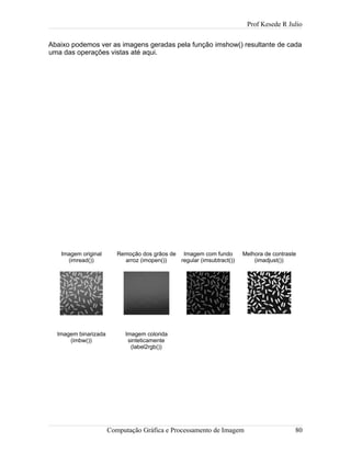 Prof Kesede R Julio
Abaixo podemos ver as imagens geradas pela função imshow() resultante de cada
uma das operações vistas até aqui.
Imagem original
(imread())
Remoção dos grãos de
arroz (imopen())
Imagem com fundo
regular (imsubtract())
Melhora de contraste
(imadjust())
Imagem binarizada
(imbw())
Imagem colorida
sinteticamente
(label2rgb())
Computação Gráfica e Processamento de Imagem 80
 