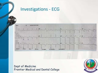 Investigations - ECG
Dept of Medicine
Frontier Medical and Dental College
 