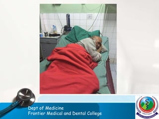 Dept of Medicine
Frontier Medical and Dental College
 