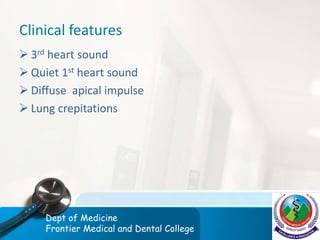 Clinical features
 3rd heart sound
 Quiet 1st heart sound
 Diffuse apical impulse
 Lung crepitations
Dept of Medicine
Frontier Medical and Dental College
 