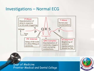 Investigations – Normal ECG
Dept of Medicine
Frontier Medical and Dental College
 