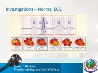 Investigations – Normal ECG
Dept of Medicine
Frontier Medical and Dental College
 