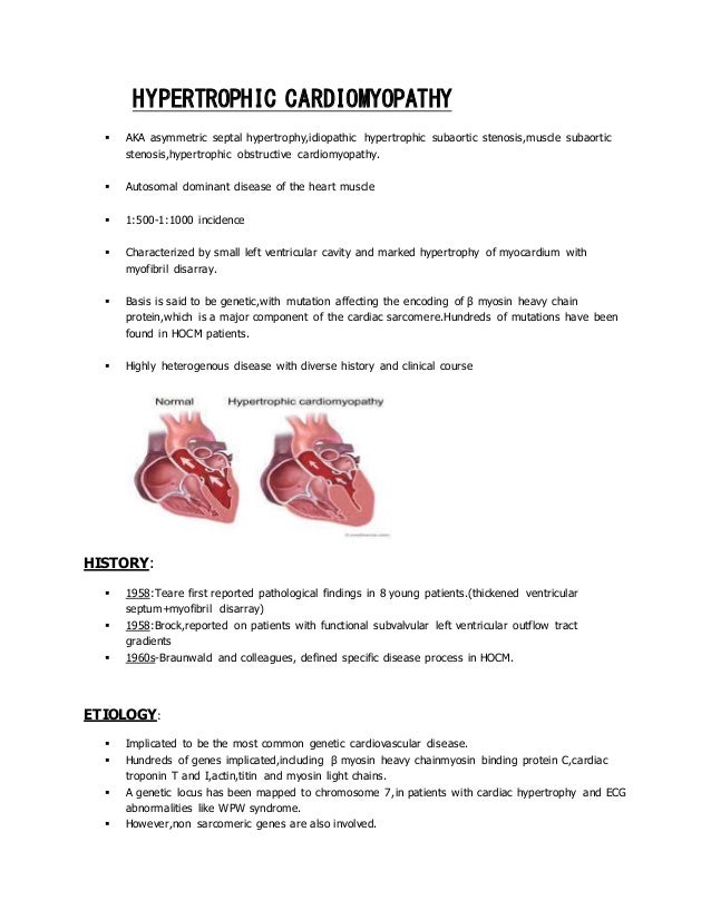 Hypertrophic Cardiomyopathy
