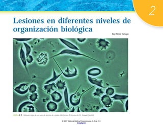 2
Lesiones en diferentes niveles de
organización biológica
Lesiones en diferentes niveles de
organización biológica Ruy Pérez Tamayo
FIGURA 2-1. Glóbulos rojos de un caso de anemia de células falciformes. (Cortesía del Dr. Joaquín Carrillo).
© 2007 Editorial Médica Panamericana, S.A de C.V.
Cisfarm
 