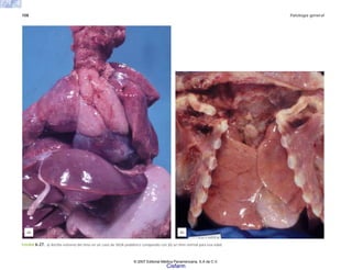 108 Patología general
FIGURA 6-27. a) Atrofia extrema del timo en un caso de SIDA pediátrico comparado con (b) un timo normal para esa edad.
(b)
(a)
© 2007 Editorial Médica Panamericana, S.A de C.V.
Cisfarm
 