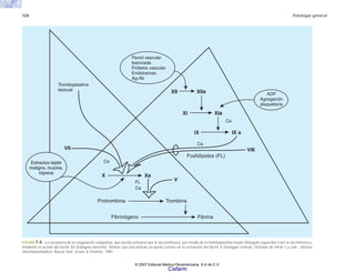 124 Patología general
FIGURA 7-4. La secuencia de la coagulación sanguínea, que puede activarse por la vía extrínseca, por medio de la tromboplastina tisular (triángulo izquierdo) o por la vía intrínseca,
mediante la acción del factor XII (triángulo derecho). Ambas vías encuentran un punto común en la activación del factor X (triángulo central). (Tomado de Hirsh J y cols.: Venous
thromboembolism. Nueva York. Grune & Stratton. 1981.
Pared vascular
lesionada
Prótesis vascular
Endotoxinas
Ag-Ab
ADP
Agregación
plaquetaria
Tromboplastina
textural
Extractos tejido
maligno, mucina,
tripsina
Extractos tejido
maligno, mucina,
tripsina
VII
Ca
Ca
Ca
Ca
FL
X Xa
V
XI
IX IX a
VIII
XII XIIa
XIa
Protrombina
Fib i
F
o
n
e
g
ó
n
i
r brina
Trombina
Fosfolípidos (FL)
© 2007 Editorial Médica Panamericana, S.A de C.V.
Cisfarm
 