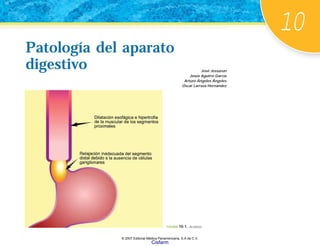 10
Patología del aparato
digestivo José Jessurun
Jesús Aguirre García
Arturo Ángeles Ángeles
Óscar Larraza Hernández
Patología del aparato
digestivo
FIGURA 10-1. Acalasia.
© 2007 Editorial Médica Panamericana, S.A de C.V.
Cisfarm
 