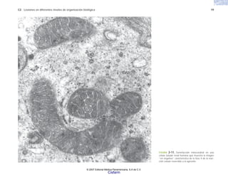 C2 Lesiones en diferentes niveles de organización biológica 19
FIGURA 2-11. Tumefacción mitocondrial en una
célula tubular renal humana que muestra la imagen
“en negativo” característica de la fase II de la reac-
ción celular reversible a la agresión.
© 2007 Editorial Médica Panamericana, S.A de C.V.
Cisfarm
 