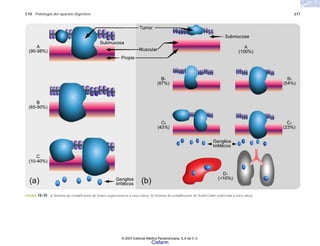 C10 Patología del aparato digestivo 217
FIGURA 10-39. a) Sistema de estadificación de Dukes (supervivencia a cinco años). b) Sistema de estadificación de Astler-Coller (sobrevida a cinco años).
© 2007 Editorial Médica Panamericana, S.A de C.V.
Cisfarm
 