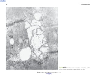 20 Patología general
FIGURA 2-12. Daño mitocondrial avanzado en el miocardio, produci-
do por emetina administrada en dosis elevada a un perro.
© 2007 Editorial Médica Panamericana, S.A de C.V.
Cisfarm
 