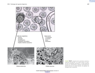 C10 Patología del aparato digestivo 247
FIGURA 10-69. Esquema de las porciones exocrina y
endocrina del páncreas. En la parte inferior se mues-
tran dos micrografías electrónicas. La célula endocrina
muestra los característicos gránulos neuroendocrinos
electrón-densos y la célula exocrina, los gránulos de
zimógeno que la identifican.
Célula acinar
m15 proteasas
m6 amilasas
mlipasa
mfosfolipasa
Célula endocrina Célula exocrina
Islote de Langerhans
mInsulina
mGlucagón
mSomatostatina
mPolipéptido pancreático
mPeptido intestinal vasoactivo
C
o
n
d
u
c
t
o
© 2007 Editorial Médica Panamericana, S.A de C.V.
Cisfarm
 