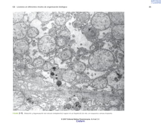 C2 Lesiones en diferentes niveles de organización biológica 23
FIGURA 2-15. Dilatación y degranulación del retículo endoplásmico rugoso en un hepatocito de rata, en respuesta a anoxia incipiente.
© 2007 Editorial Médica Panamericana, S.A de C.V.
Cisfarm
 