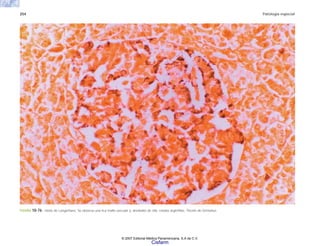254 Patología especial
FIGURA 10-76. Islote de Langerhans. Se observa una rica malla vascular y, alrededor de ella, células argirófilas. Tinción de Grimelius.
© 2007 Editorial Médica Panamericana, S.A de C.V.
Cisfarm
 