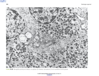 258 Patología especial
FIGURA 10-80. Micrografía electrónica de células α. Los gránulos son redondos, electrodensos y con un nucleoide de textura granular.
© 2007 Editorial Médica Panamericana, S.A de C.V.
Cisfarm
 