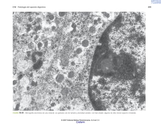 C10 Patología del aparato digestivo 259
FIGURA 10-81. Micrografía electrónica de una célula β. Los gránulos son de tamaño y densidad variable, con halo amplio; algunos de ellos tienen aspecto cristaloide.
© 2007 Editorial Médica Panamericana, S.A de C.V.
Cisfarm
 