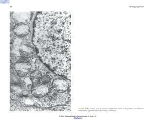26 Patología general
FIGURA 2-18. Estadio 3 de la reacción inespecífica celular a la agresión, con dilatación
mitocondrial y pérdida parcial de cristas y contenido.
© 2007 Editorial Médica Panamericana, S.A de C.V.
Cisfarm
 