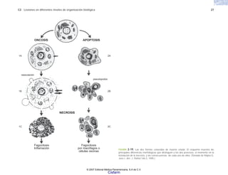 C2 Lesiones en diferentes niveles de organización biológica 27
FIGURA 2-19. Las dos formas conocidas de muerte celular. El esquema muestra las
principales diferencias morfológicas que distinguen a los dos procesos, el momento en la
instalación de la necrosis, y las consecuencias de cada uno de ellos. (Tomado de Majno G.
Joris I. Am. J. Pathol 146:3, 1995.)
ONCOSIS
vesiculación
APOPTOSIS
pseudopodos
2A
2B
2C
1A
1B
1C
Fagocitosis
Inflamación
Fagocitosis
por macófagos o
células vecinas
NECROSIS
© 2007 Editorial Médica Panamericana, S.A de C.V.
Cisfarm
 