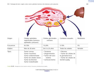 C12 Patología del útero, vagina, vulva, ovario, glándula mamaria, del embarazo y de la placenta 323
FIGURA 12-25. Histogénesis de los tumores ováricos, frecuencia y distribución por edades.
Origen Células epiteliales Células germinales Cordones sexuales Metástasis
superficiales (tumores estroma
epiteliales comunes)
Frecuencia 65-70% 15-20% 5-10% 5%
Edades Más de 20 años De 0 a 25 años Todas las edades Variable
Tipos Tumor seroso • Teratoma • Fibroma
Tumor mucinoso • Disgerminoma • Tumor de células de
Tumor endometrioide • Tumor del saco la granulosa-teca
Tumor de células claras vitelino • Tumor de células de
Tumor de Brenner • Coriocarcinoma Sertoli-Leydig
Tumor inclasificable
© 2007 Editorial Médica Panamericana, S.A de C.V.
Cisfarm
 