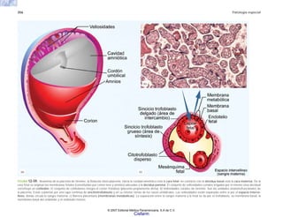 356 Patología especial
FIGURA 12-59. Anatomía de la placenta de término. a) Relación útero-placenta. Hacia la cavidad amniótica está la cara fetal; en contacto con la decidua basal está la cara materna. De la
cara fetal se originan las membranas fetales (constituidas por corion leve y amnios) adosadas a la decidua parietal. El conjunto de vellosidades coriales irrigadas por el mismo vaso decidual
constituye un cotiledón. El conjunto de cotiledones integra el corion frondoso (placenta propiamente dicha). b) Vellosidades coriales de término. Son las unidades anatomofuncionales de
la placenta. Están cubiertas por una capa continua de sincitiotrofoblasto y en su interior ramas de los vasos umbilicales. Las vellosidades están separadas entre sí por el espacio interve-
lloso, donde circula la sangre materna. c) Barrera placentaria (membranas metabólicas). La separación entre la sangre materna y la fetal se da por el trofoblasto, su membrana basal, la
membrana basal del endotelio y el endotelio mismo.
(a) (c)
(b)
© 2007 Editorial Médica Panamericana, S.A de C.V.
Cisfarm
 