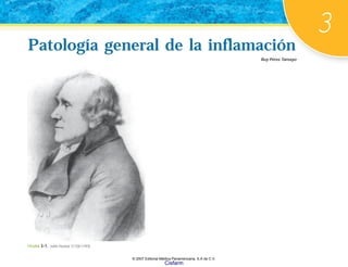 3
Patología general de la inflamación
Patología general de la inflamación
Ruy Pérez Tamayo
FIGURA 3-1. John Hunter (1728-1793).
© 2007 Editorial Médica Panamericana, S.A de C.V.
Cisfarm
 